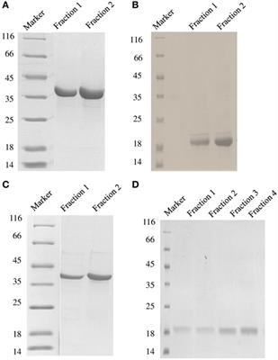 Complement Protein C1q Interacts with DC-SIGN via Its Globular Domain and Thus May Interfere with HIV-1 Transmission